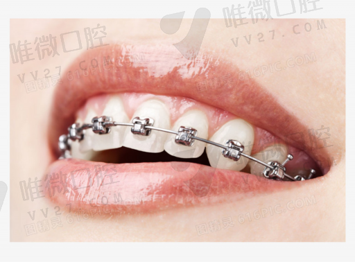 成人可不可以窝沟封闭,窝沟封闭刷法(图1)